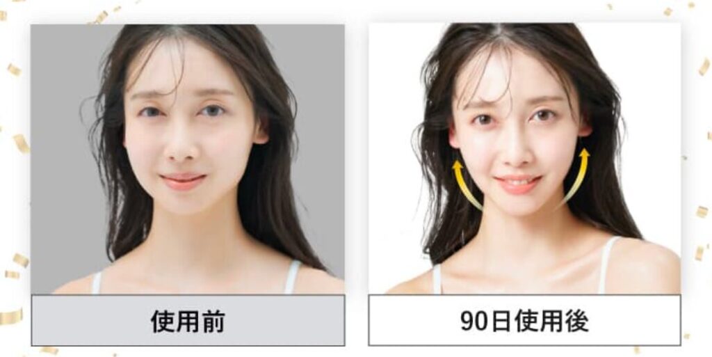 ディマーニRF美顔器を使った結果